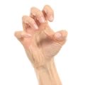 claw-hand